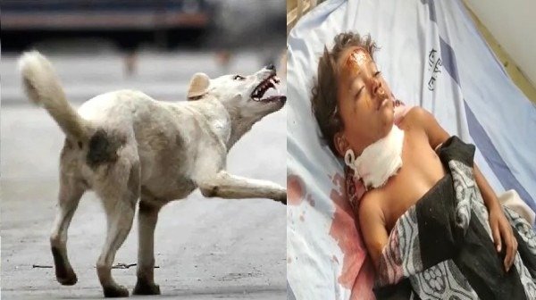  Jhansi News: ‘पागल’ कुत्ते ने बच्ची को काटा , बच्ची ने 49 लोगों को काटकर किया घायल !