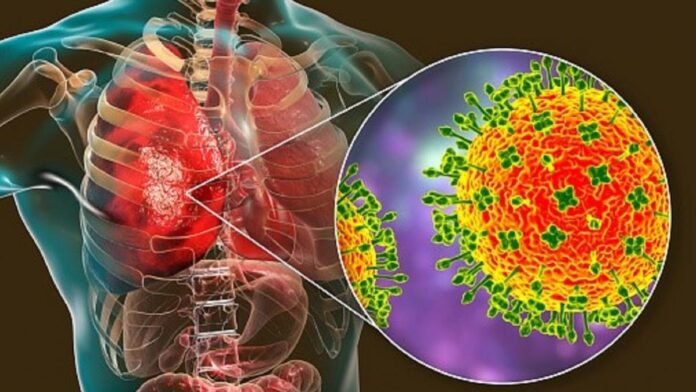 निपाह वायरस| Nipah Virus In India