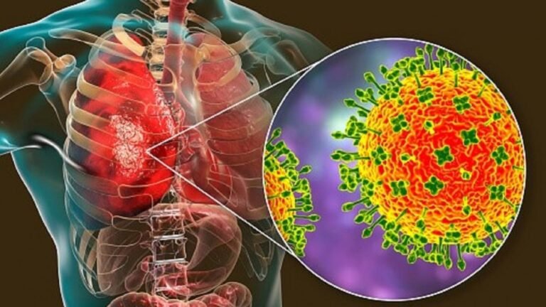 निपाह वायरस| Nipah Virus In India