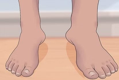 प्रदेश को फाइलेरिया मुक्त बनाने को मिशन मोड में योगी सरकार !