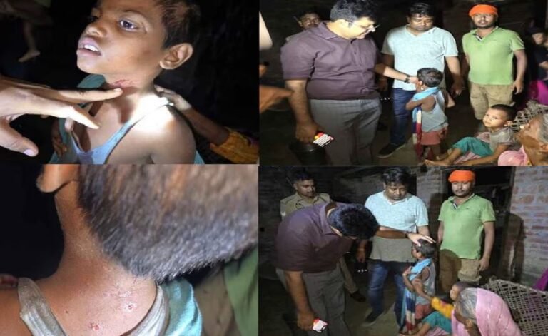 बहराइच में आदमखोर भेड़िये ने बच्ची पर किया हमला, 10 लोगों को बना चुका है शिकार, योगी ने बुलाई मीटिंग