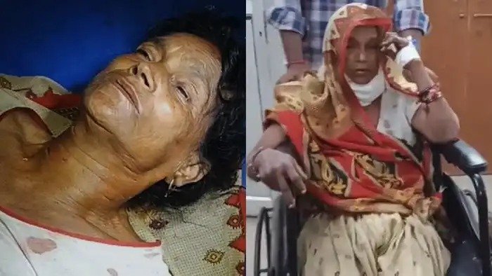 बहराइच: बरामदे में सो रही महिला पर भेड़िये का हमला, गंभीर हालत में मेडिकल कॉलेज रेफर