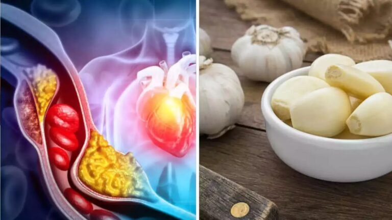Consumption Of Raw Garlic: कच्चे लहसुन का करें सेवन, यूरिक एसिड और हाई कोलेस्ट्रॉल को करे कंट्रोल !