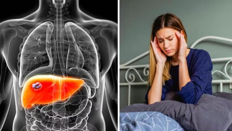Bay Leaf Water for Fatty Liver: आपको भी है फैटी लिवर की समस्या ? तो अपनाएं ये असरदार तरीका !