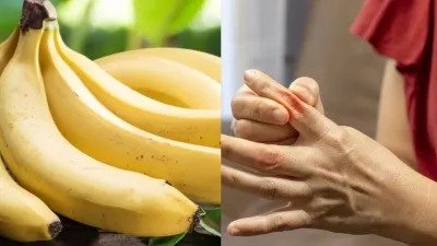यूरिक एसिड के रोगियों के लिए केला: दर्द से राहत और पेट की सफाई में मददगार