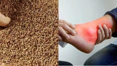 Uric Acid: यूरिक एसिड को कंट्रोल करने में अजवाइन है कारगर, जानें कैसे करें सेवन और इसके अन्य फायदे