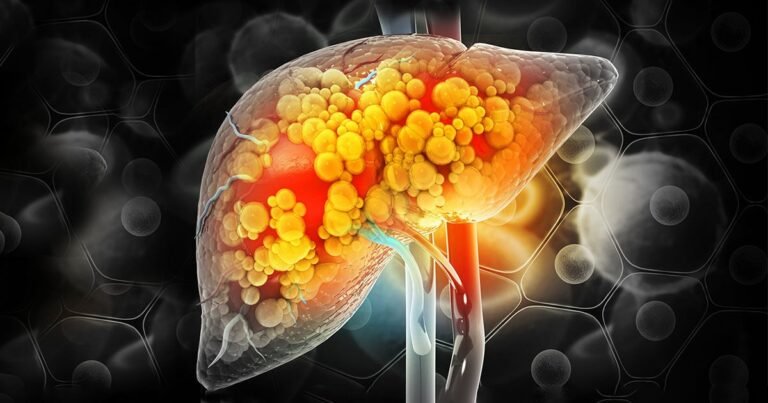 Problem Of Fatty Liver: योग और आयुर्वेद से होगा लिवर मजबूत, फैटी लिवर जैसी बीमारियों का होगा अंत